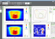 myqa-patients-mainscreen-isodoses.png